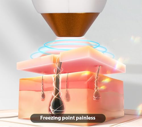 2025 Latest Professional Hair Removal Machine Ice Handle Hair Removal Device 6BAR - Image 6