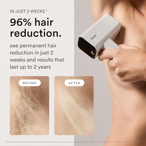 Nood™ NEW Flasher Pro — IPL Laser Hair Removal Device & Anti-Aging Red Light Therapy for Women & Men — Pain-free, Permanent, Visible Results After First Use & Works Everywhere Hair Grows — Gloss White - Image 3