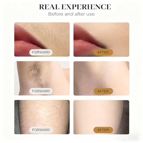 TAixl 808nm Hair Removal Device with CoolTouch Technology - Professional At-Home Permanent Hair Reduction System for Face & Body, Painless & Long-Lasting Results - Image 8