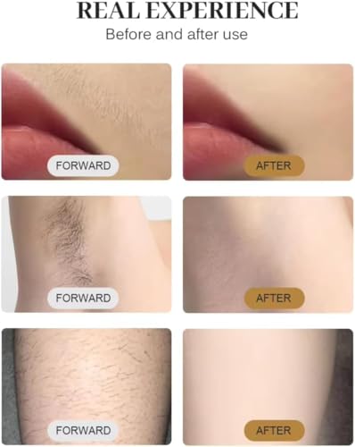 Professional Painless Hair Removal Machine, Large Screen Multifunctional Hair Removal Device, Fast Permanent Hair Removal Device - Image 8