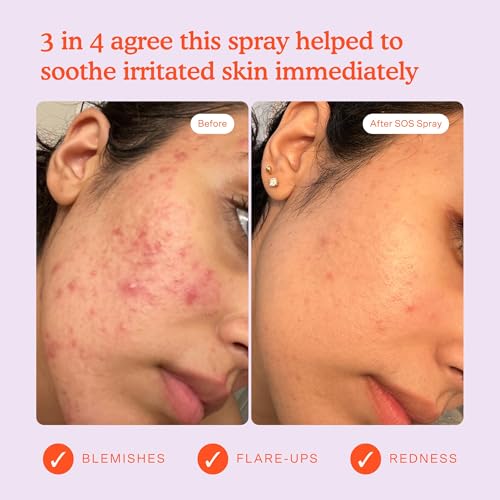 Tower 28 Jumbo SOS Recovery Face Cream - Hydrating Face Moisturizer with Hyaluronic Acid + Ceramides - Skin Barrier Repair Moisturizer Reduces Redness + Improves Texture - Sensitive Skin Care (16 oz) - Image 7