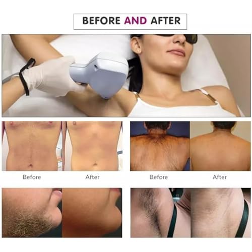 TAixl 808nm Hair Removal Device with CoolTouch Technology - Professional At-Home Permanent Hair Reduction System for Face & Body, Painless & Long-Lasting Results - Image 7