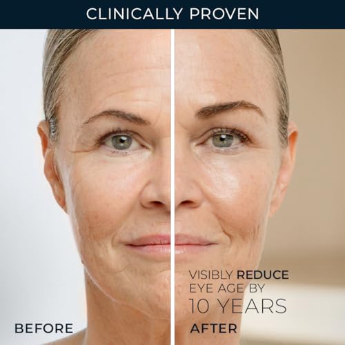 RoC Retinol Correxion Under Eye Cream for Dark Circles & Puffiness, Daily Wrinkle Cream, Anti Aging Skin Care Treatment Women and Men, 0.5 oz (Packaging May Vary) - Image 4