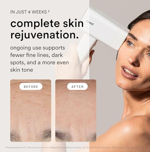 Nood™ NEW Flasher Pro — IPL Laser Hair Removal Device & Anti-Aging Red Light Therapy for Women & Men — Pain-free, Permanent, Visible Results After First Use & Works Everywhere Hair Grows — Gloss White - Image 4