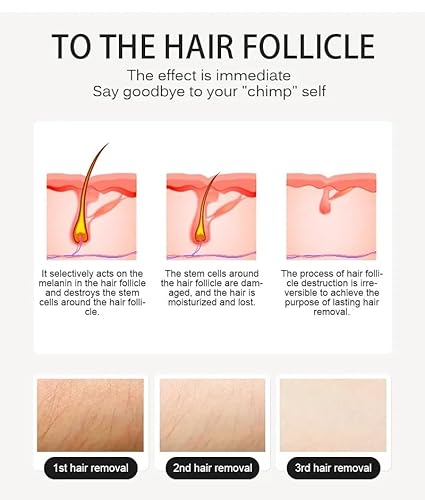 2-In-1 Hair Removal And Age Spot Removal Device, Smart Touchscreen Beauty Tool, Painless And Gentle Permanent Hair Removal Equipment - Image 6