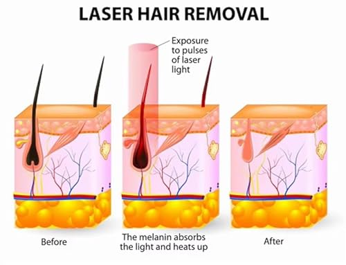 Full Body Hair Removal Machine For Men And Women, Professional Painless Hair Removal Equipment, Home Salon Beauty Device - Image 8