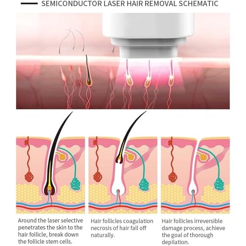 TAixl 808nm Hair Removal Device with CoolTouch Technology - Professional At-Home Permanent Hair Reduction System for Face & Body, Painless & Long-Lasting Results - Image 5