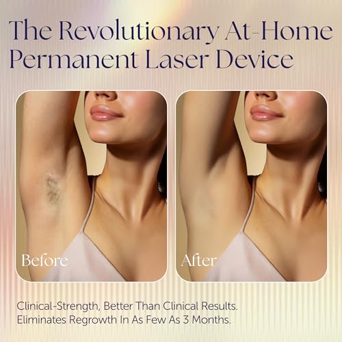 Epilaser At-Home True Laser Hair Removal Device for Light Skin, Safe, Intelligent, Painless and Permanent Hair Removal for Face, Body, Bikini Line - Image 8