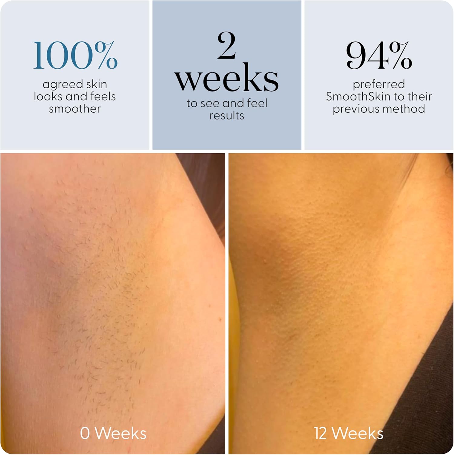 SmoothSkin Pure Adapt Green IPL Hair Removal Device, At-Home Laser Hair Removal for Women & Men, Visible Results in 2 Weeks, Safe for Face & Body, Painless, Long-Lasting Hair Reduction, Full Body Use - Image 5