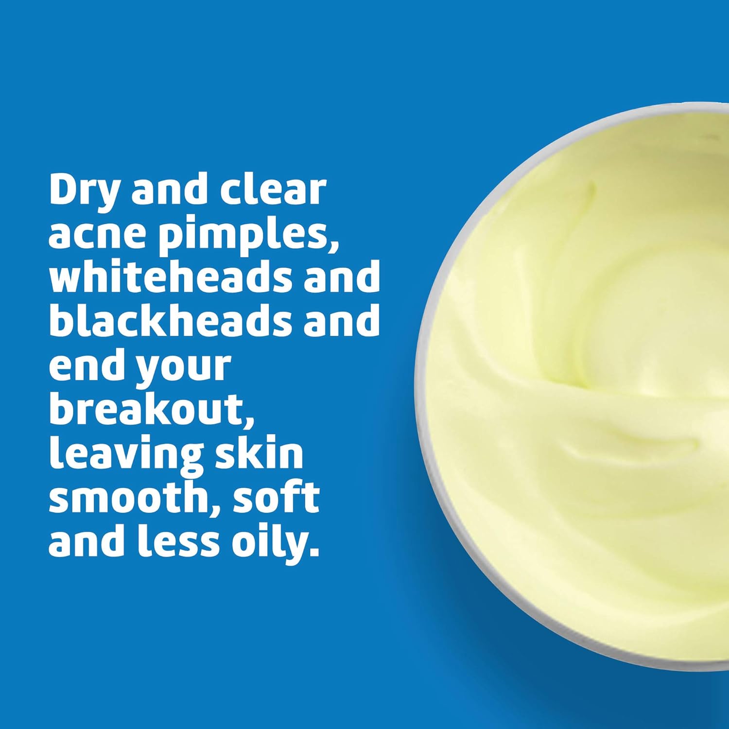 De La Cruz 10% Sulfur Ointment - Cystic Acne Treatment for Face and Body - Daily 10 Min Spot Treatment Mask - Safe and Effective Game Changing Hormonal Acne Treatment That Clears Up Pimples - 2.6 oz - Image 4