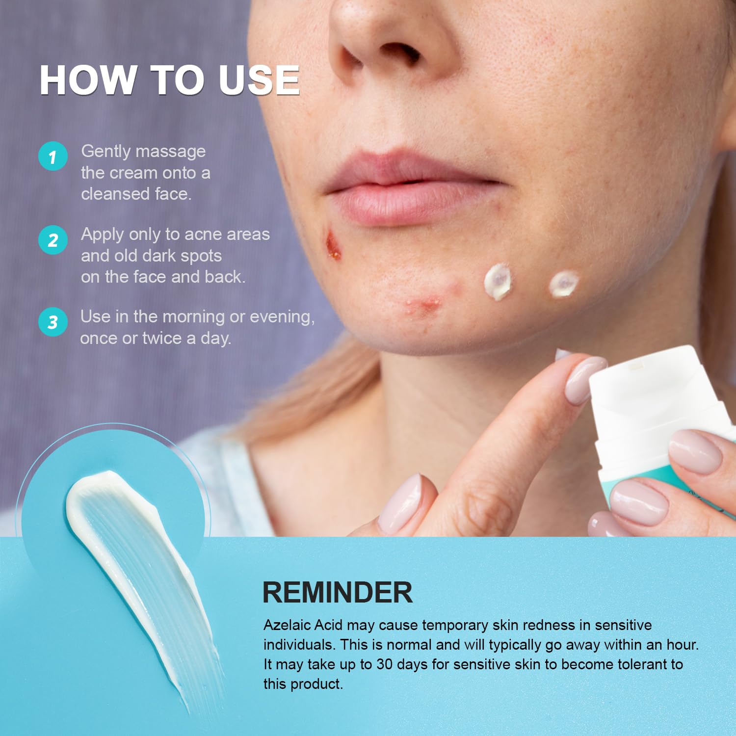 Acne Pimple Spot Treatment Cream: Cystic Hormonal Breakouts Control for Face & Back - 2% Salicylic Acid, Fast Redness Relief, Fades Blemishes & Post-Acne Marks, Teens-Adults, 1.8 oz - Image 6