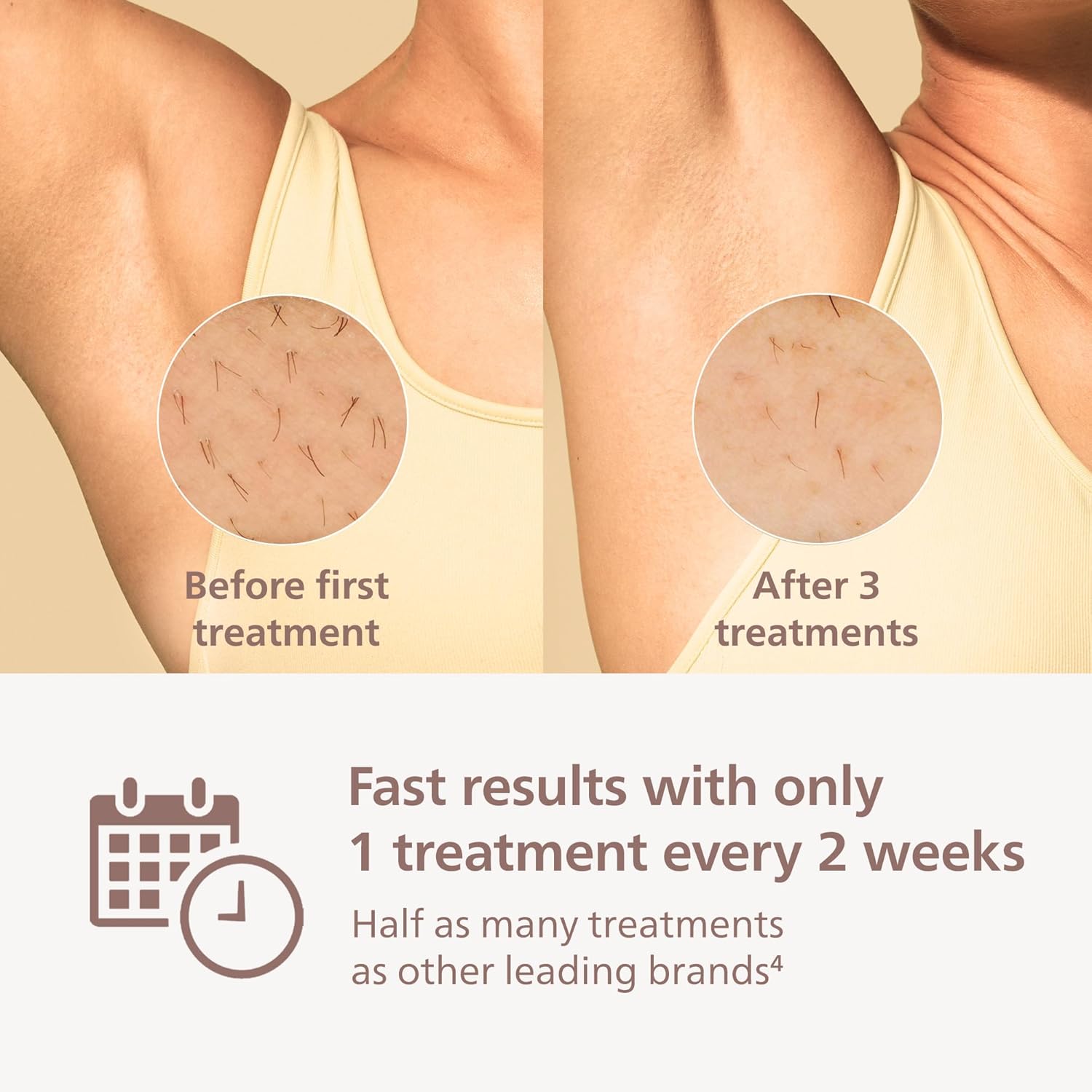 Philips Lumea 8000 Series IPL Hair Removal Device, Permanent Laser Hair Reduction for Women & Men, Easy and Comfortable Use at Home, SenseIQ, 3 Attachments for Body, Face, Intimate, BRI937/03 - Image 4