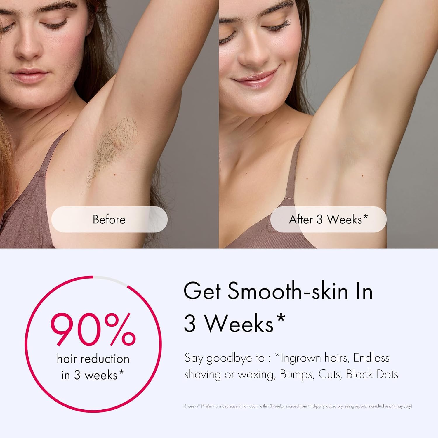 Ulike Laser Hair Removal for Women and Men, Air 3 Ice-Cooling IPL Hair Removal Device for Nearly Painless & Long-Lasting Results, 3 Modes & Auto Flashing for Fast Full Body Hair Removal from Home - Image 3