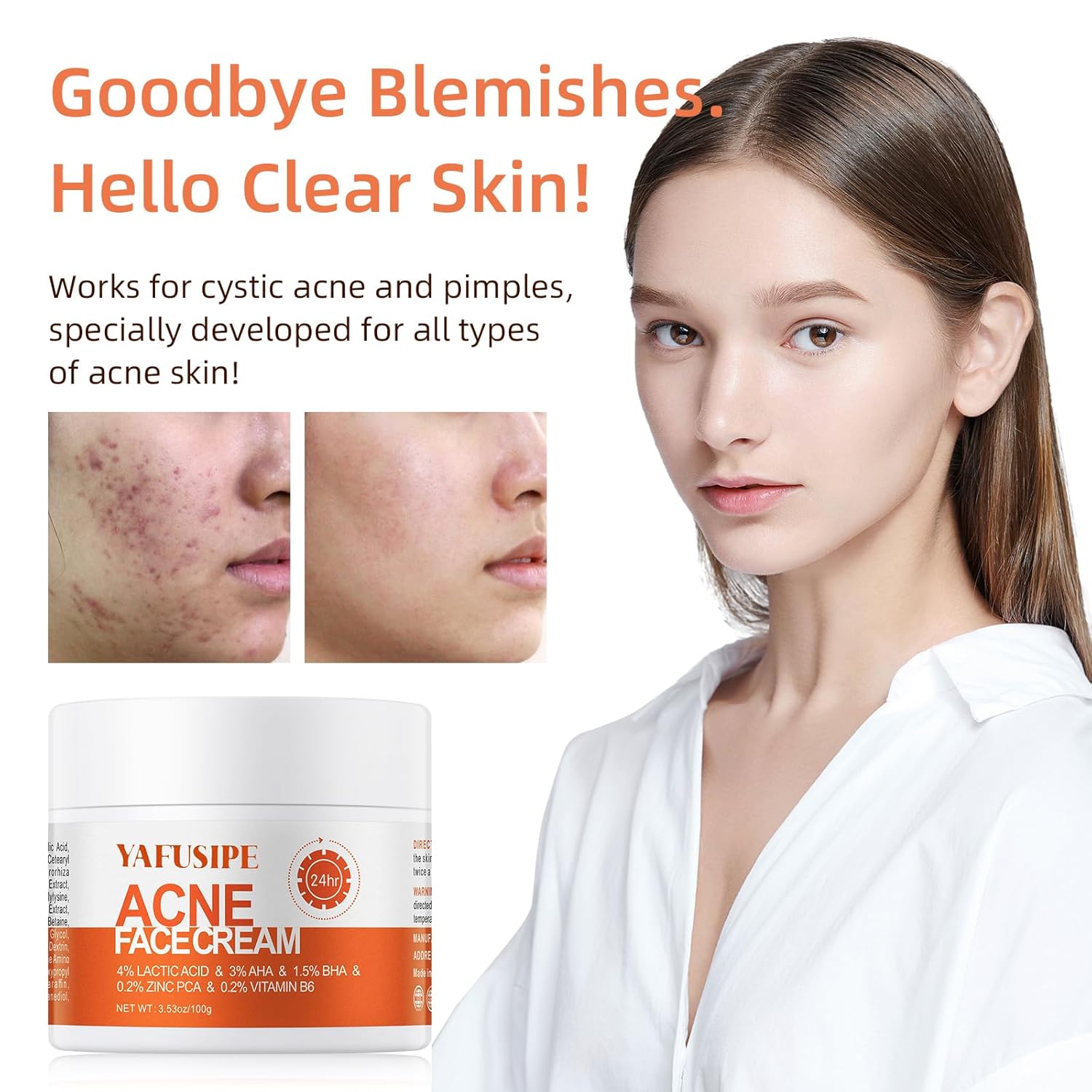 Acne Treatment for Face for Hormonal Cystic Stubborn Acne Cream for Sensitive Skin Teens Adults Women Men Spot Pimple Butt Control Rapid Clearing Breakout Overnight Face Blemish Treatment - Image 3