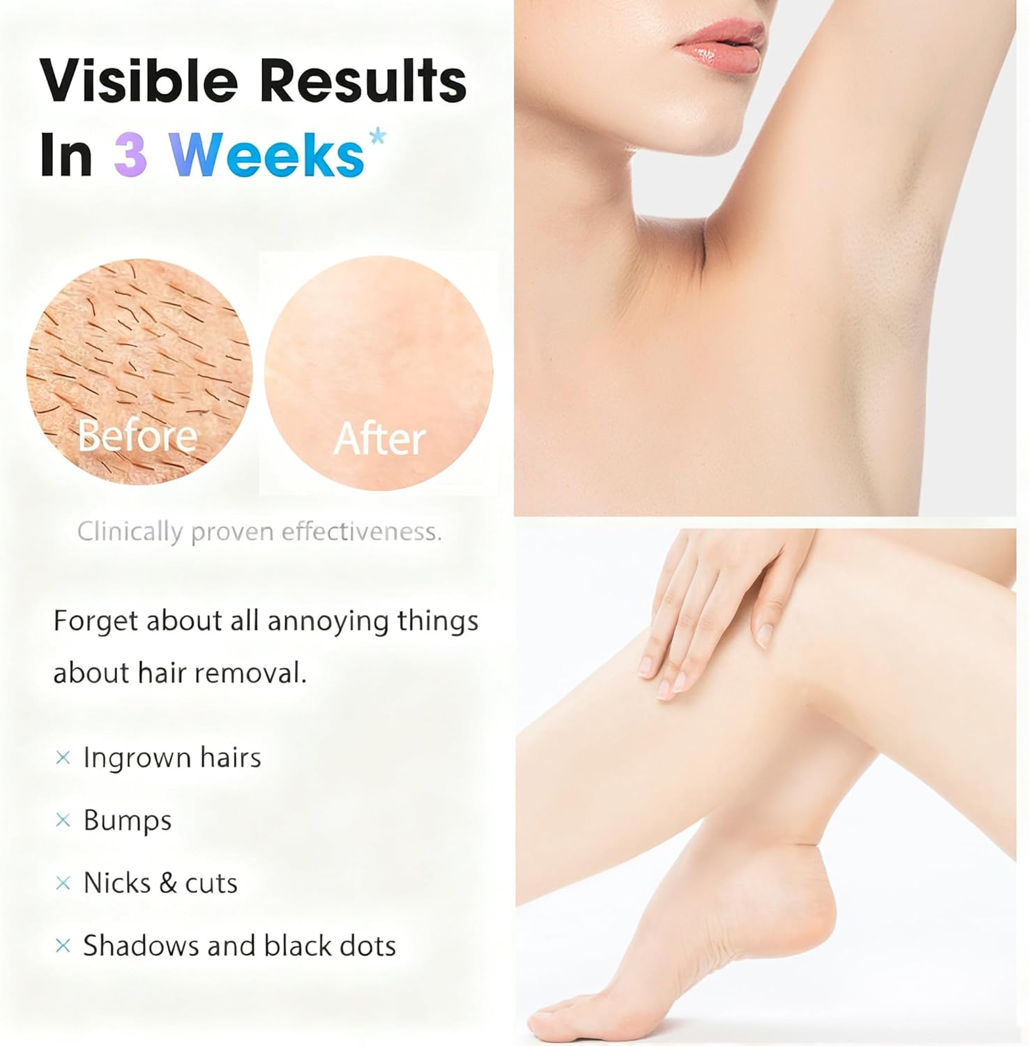 IPL Laser Hair Removal Device for Women & Men - at-Home Painless Ultra-Fast Flash Hair Remover, 86% Hair Reduction in 4 Weeks, High Energy & 5 Modes, 8 Mins Full Body & Bikini Line & More - Image 2