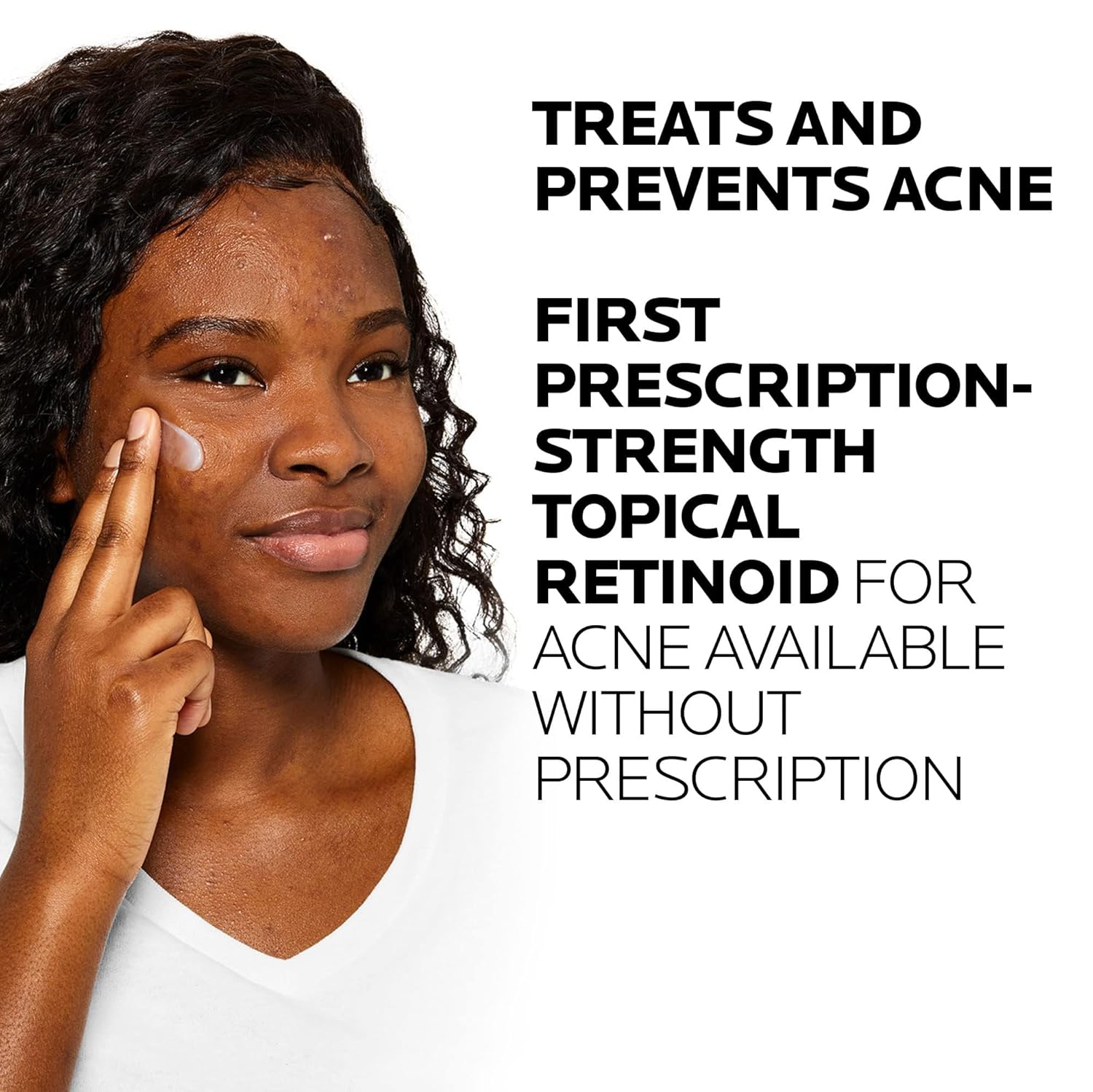 La Roche-Posay Effaclar Adapalene Gel 0.1% Acne Treatment, Retinoid Cream, Acne Medication Gel For Blackheads & Whiteheads, Oil Free, Helps Clear And Prevent Blemishes & Clogged Pores - Image 5