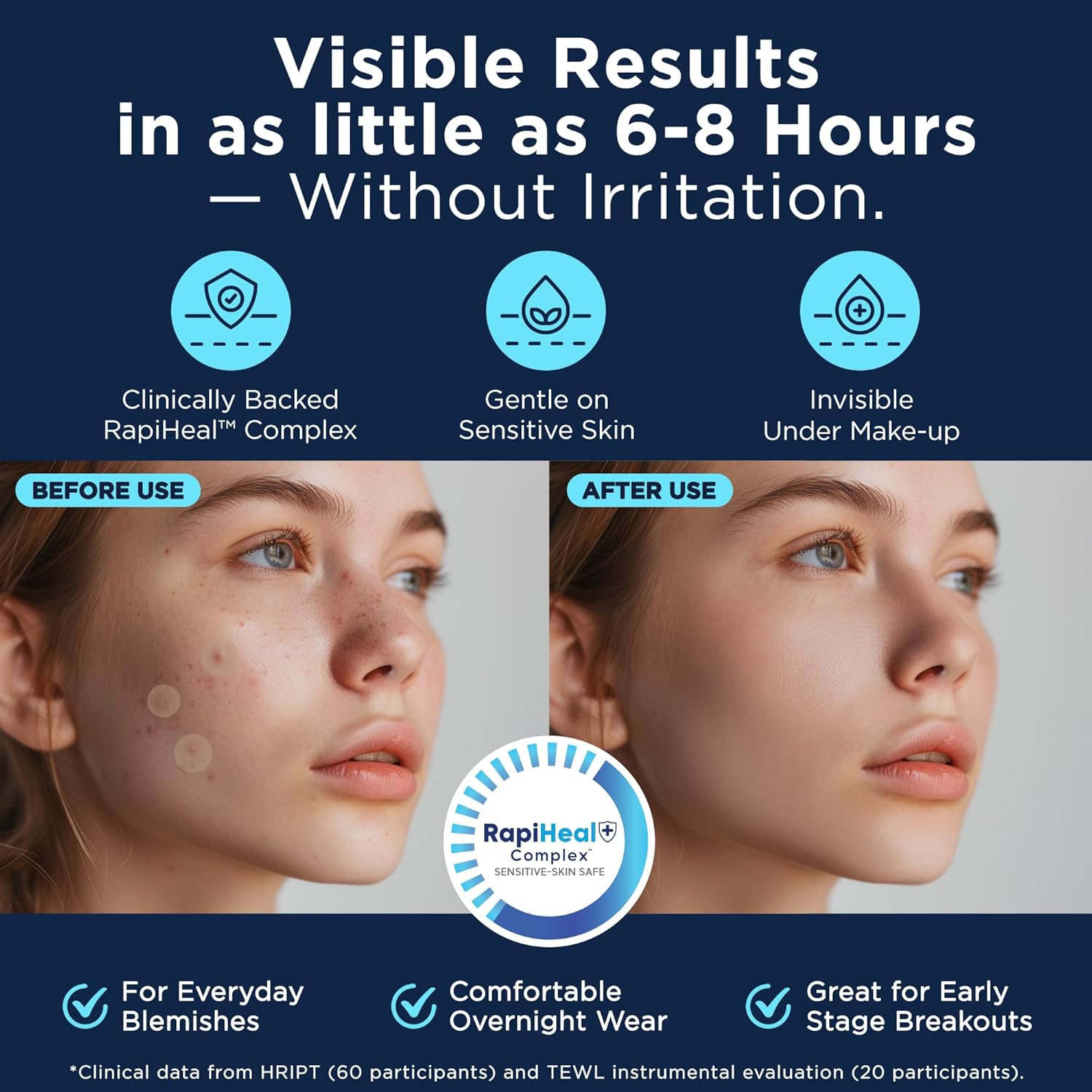 Pimple Patches for Face - 134 Count Hydrocolloid Acne Patches - Zit, Blemish, Cystic Acne Dots & Dark Spot Treatment - Invisible Clear Pimple Patch Stickers for Forehead, Chin, Nose, 3 Sizes (S, M, L) - Image 4