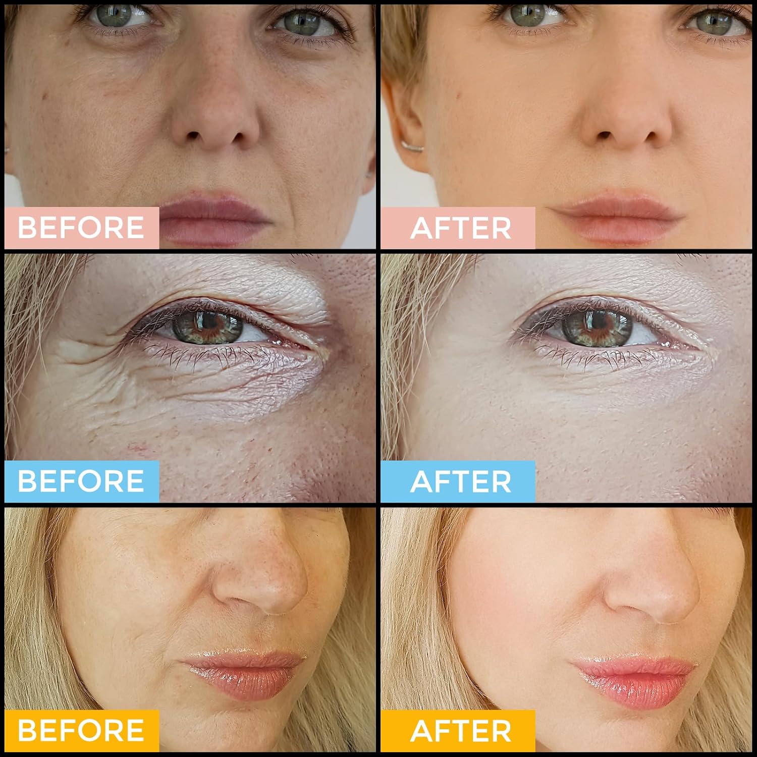 Facial Skin Care Set– Retinol Serum, Vitamin C & Hyaluronic Acid for Face – Anti Aging Face Serum Set for Women – Firm, Wrinkle Smoothing, Dark Spot Corrector, Brighten Dullness - Image 4