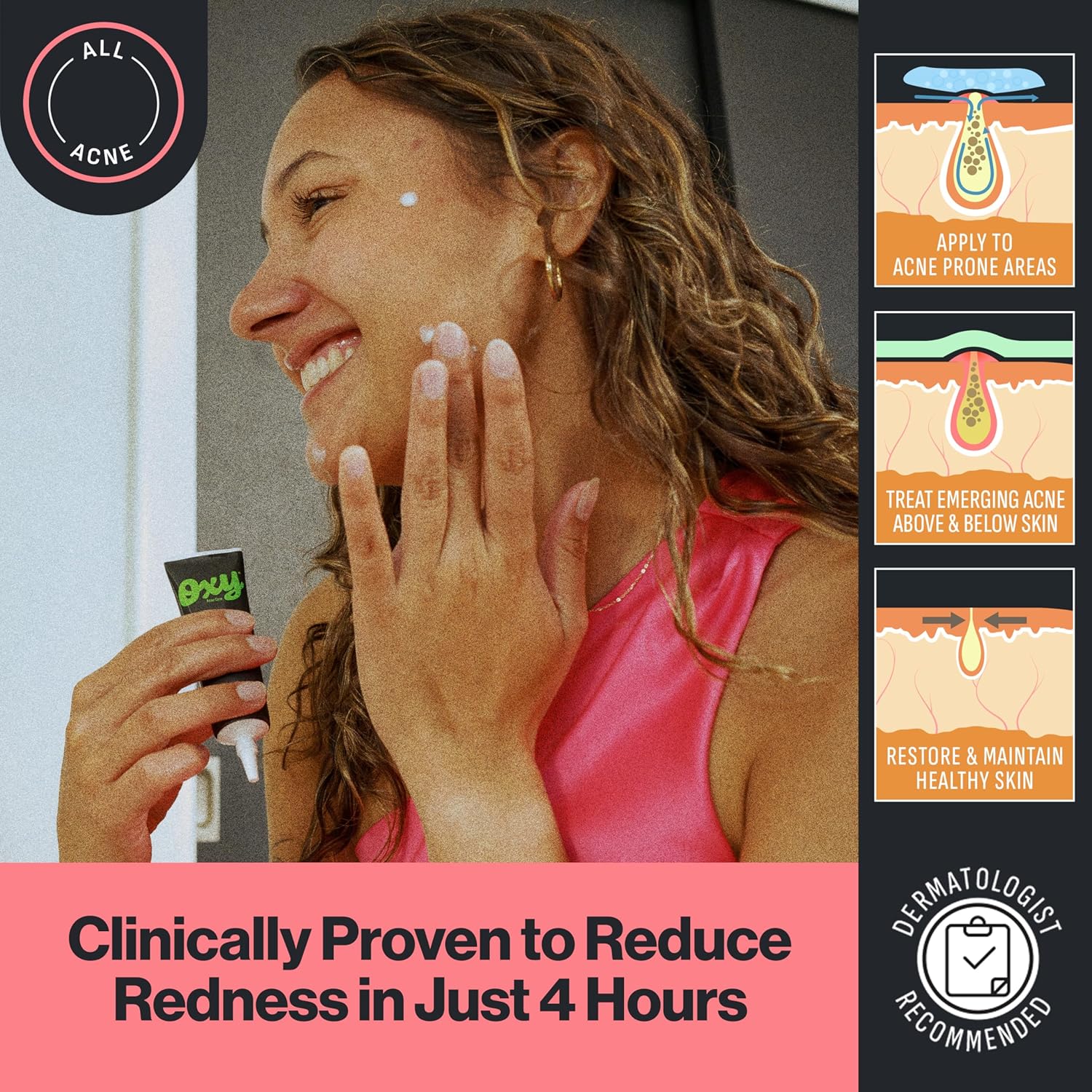 Oxy Rapid Acne Spot Treatment For Face & Body, Maximum Strength 10% Benzoyl Peroxide Acne Blemish Cream Medication for Acne and Blackheads, Prebiotic Pimple Cream for Acne Prone Skin Care, 1 oz - Image 5