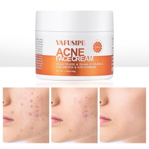 Acne Treatment for Face for Hormonal Cystic Stubborn Acne Cream for Sensitive Skin Teens Adults Women Men Spot Pimple Butt Control Rapid Clearing Breakout Overnight Face Blemish Treatment