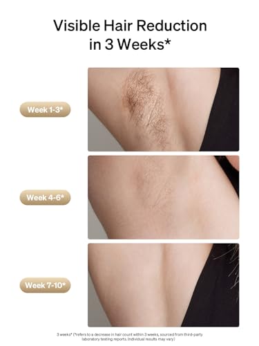 Ulike Laser Hair Removal, Air 3 IPL Hair Removal with Gift Set, Sapphire Ice-Cooling for Nearly Painless Treatment & Long-Lasting Hair Removal Results, Safe for Whole Body Use - Image 4