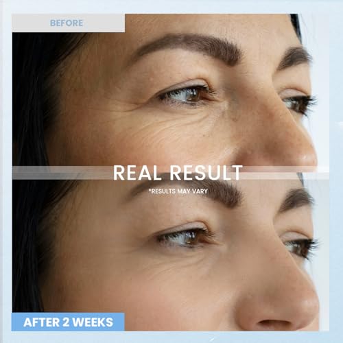 Retinol Eye Cream for Dark Circles: Anti-Wrinkle Under Eye Cream - Night Care Eye Cream Reduces Eye Bags 0.5 fl. oz - Image 4