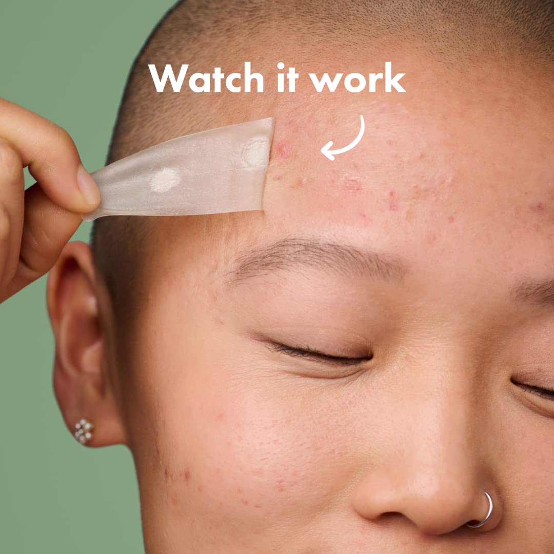 Mighty Patch Surface Large Pimple Patches for Face from Hero Cosmetics, Acne Spot for Body, Cheek, Forehead, and Chin, Pimple Stickers, Hydrocolloid Covers, Vegan-friendly, 10 Count - Image 4