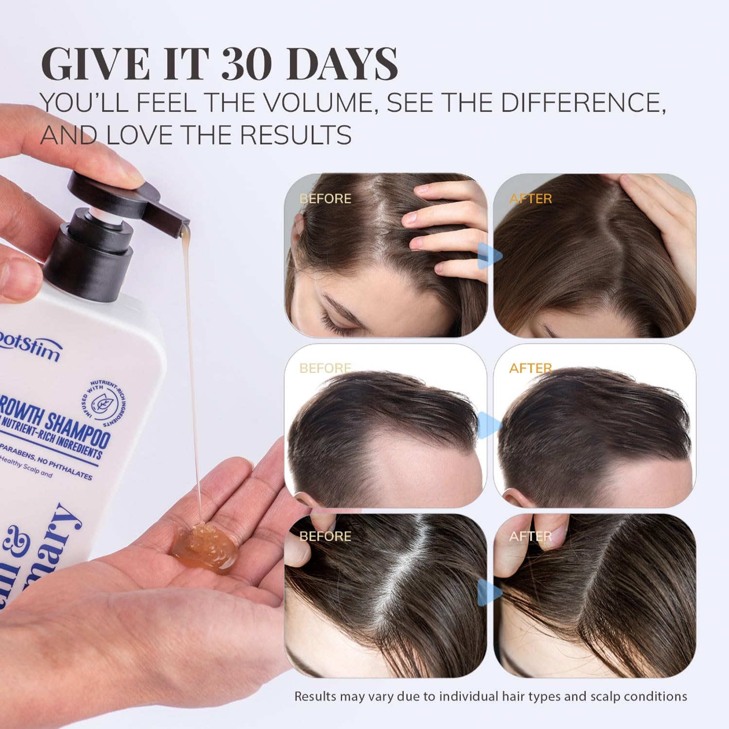 Biotin & Rosemary Shampoo for Hair Growth: Hair Loss Shampoo for Thinning Hair Infused with Nutrient Rich Ingredients for Hair thickening Sulfate Free 10 fl oz - Image 5