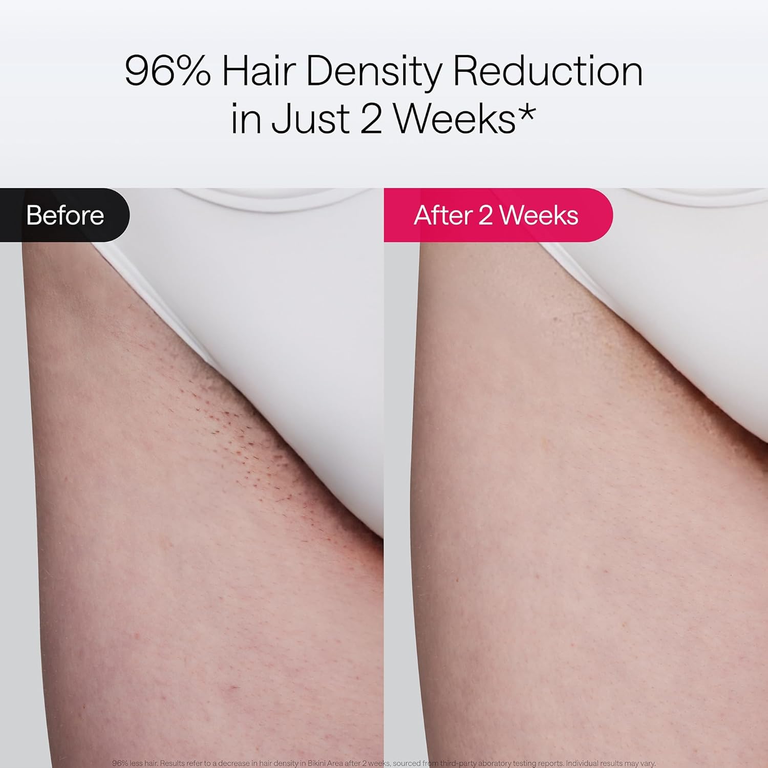 Ulike Laser Hair Removal Air 10 Deluxe Version IPL for for Women and Men with Ice-Cooling Technology, Nealy Painless and Permanent Hair Reduction, at Home Hair Removal in 10mins with Skin Sensor - Image 5