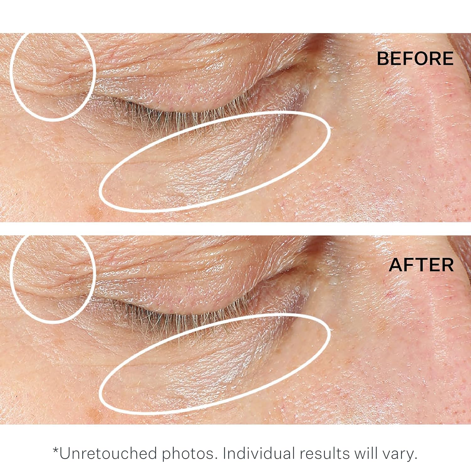 StriVectin Anti-Wrinkle Intensive Eye Cream Concentrate for Wrinkles PLUS, Targets Crow's Feet, Firmness, Puffiness & Dark Circles,White, 0.25 Fl oz (Pack of 1) - Image 5