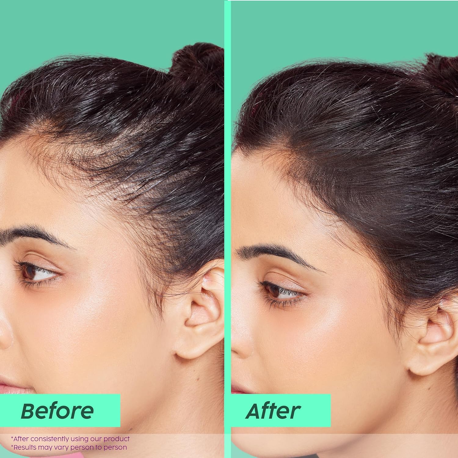 Plix Rosemary Advanced Shampoo for Clean, Smooth Hair | Gentle Sulfate-Free Cleanser for Daily Use | Lightweight Scalp Refresh | For All Hair Types, 6.76 fl oz - Image 3