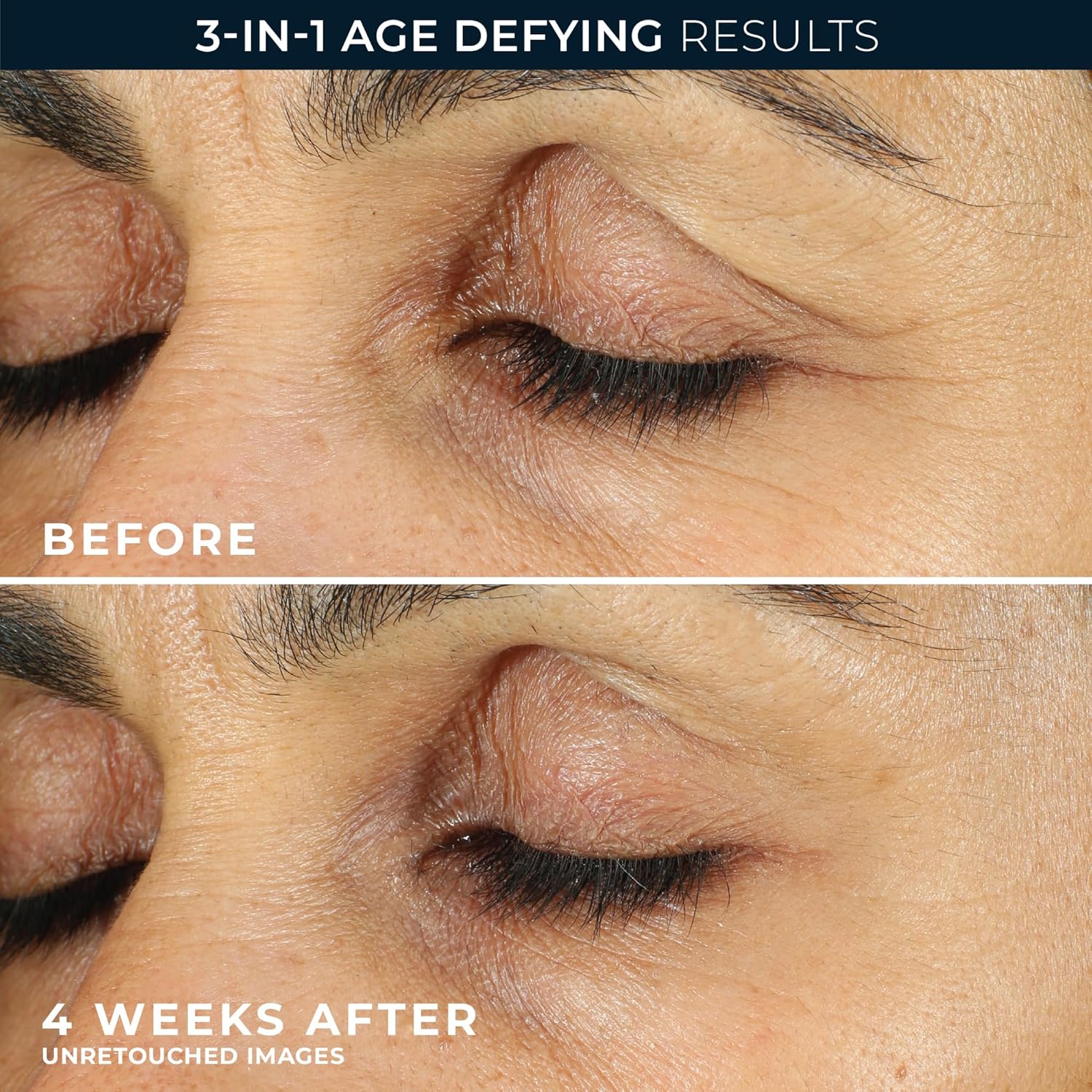 RoC Retinol Correxion Eye Cream Mini for Dark Circles & Puffiness, Daily Wrinkle Cream, Anti Aging Line Smoothing Skin Care Treatment, .25 Ounces - Image 6